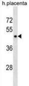 PP17 antibody, abx030610, Abbexa, Western Blot image 