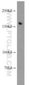 Tyrosine Kinase With Immunoglobulin Like And EGF Like Domains 1 antibody, 19329-1-AP, Proteintech Group, Western Blot image 