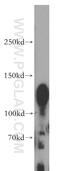 Plakophilin 4 antibody, 14062-1-AP, Proteintech Group, Western Blot image 