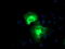 Proteasome 26S Subunit, Non-ATPase 2 antibody, TA503217, Origene, Immunofluorescence image 