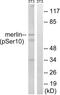 SCH antibody, LS-C199256, Lifespan Biosciences, Western Blot image 
