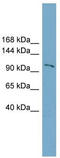 Cap Methyltransferase 2 antibody, TA344873, Origene, Western Blot image 