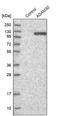 ADAM Metallopeptidase Domain 30 antibody, PA5-55288, Invitrogen Antibodies, Western Blot image 