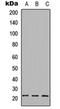 BCL2 Associated Agonist Of Cell Death antibody, orb304694, Biorbyt, Western Blot image 