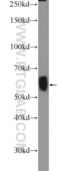 Glutamate Decarboxylase 2 antibody, 21760-1-AP, Proteintech Group, Western Blot image 