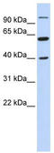 Leucine Zipper And EF-Hand Containing Transmembrane Protein 2 antibody, TA340348, Origene, Western Blot image 
