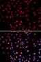 DNA polymerase delta catalytic subunit antibody, LS-C333982, Lifespan Biosciences, Immunofluorescence image 