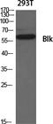 BLK Proto-Oncogene, Src Family Tyrosine Kinase antibody, A01539-1, Boster Biological Technology, Western Blot image 