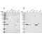 Biphenyl Hydrolase Like antibody, PA5-57799, Invitrogen Antibodies, Western Blot image 