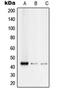 RUNX Family Transcription Factor 3 antibody, orb213670, Biorbyt, Western Blot image 