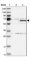 Zinc Finger Protein 189 antibody, NBP1-85915, Novus Biologicals, Western Blot image 