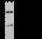 Zeta Chain Of T Cell Receptor Associated Protein Kinase 70 antibody, 102124-T32, Sino Biological, Western Blot image 