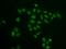 FACT antibody, GTX54690, GeneTex, Immunocytochemistry image 