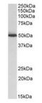 Aldehyde dehydrogenase, mitochondrial antibody, orb20572, Biorbyt, Western Blot image 