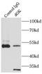 Deoxyguanosine kinase, mitochondrial antibody, FNab02355, FineTest, Immunoprecipitation image 
