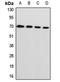 Lymphocyte Cytosolic Protein 1 antibody, LS-C667888, Lifespan Biosciences, Western Blot image 