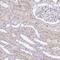 Protein Kinase N3 antibody, PA5-63553, Invitrogen Antibodies, Immunohistochemistry frozen image 