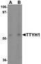 Protein tweety homolog 1 antibody, A07215, Boster Biological Technology, Western Blot image 
