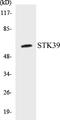 Serine/Threonine Kinase 39 antibody, EKC1550, Boster Biological Technology, Western Blot image 