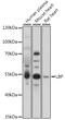 Lipopolysaccharide Binding Protein antibody, 16-962, ProSci, Western Blot image 