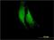 Chymotrypsin-like elastase family member 1 antibody, H00001990-M02, Novus Biologicals, Immunocytochemistry image 