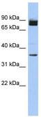 Coiled-Coil Serine Rich Protein 1 antibody, TA335111, Origene, Western Blot image 