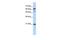 Germinal Center Associated Signaling And Motility antibody, GTX45254, GeneTex, Western Blot image 