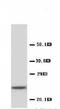 C-Reactive Protein antibody, LS-C171550, Lifespan Biosciences, Western Blot image 