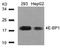 Eukaryotic Translation Initiation Factor 4E Binding Protein 1 antibody, AP02725PU-S, Origene, Western Blot image 