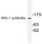 Insulin Receptor Substrate 1 antibody, AP20831PU-N, Origene, Western Blot image 