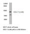 Lpa3 antibody, LS-C177144, Lifespan Biosciences, Western Blot image 