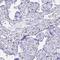 Zinc Finger Protein 850 antibody, NBP2-34185, Novus Biologicals, Immunohistochemistry paraffin image 
