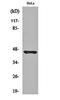 Kallikrein B1 antibody, orb159426, Biorbyt, Western Blot image 