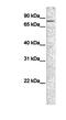 Cadherin 12 antibody, NBP1-59225, Novus Biologicals, Western Blot image 