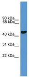 Parkin RBR E3 Ubiquitin Protein Ligase antibody, TA329563, Origene, Western Blot image 