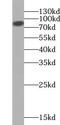 VAC14 Component Of PIKFYVE Complex antibody, FNab09356, FineTest, Western Blot image 