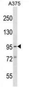 Synapse Defective Rho GTPase Homolog 1 antibody, AP54119PU-N, Origene, Western Blot image 