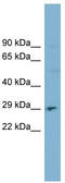 Deoxyribonuclease-1 antibody, TA339005, Origene, Western Blot image 