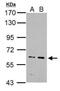 IKAROS Family Zinc Finger 4 antibody, NBP2-42867, Novus Biologicals, Western Blot image 
