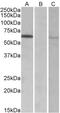 SID1 Transmembrane Family Member 1 antibody, 42-866, ProSci, Western Blot image 