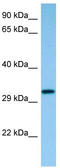 Capping Actin Protein Of Muscle Z-Line Subunit Beta antibody, TA344343, Origene, Western Blot image 