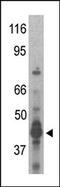 Protein Arginine Methyltransferase 6 antibody, AP11013PU-N, Origene, Western Blot image 