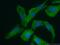 PDZ And LIM Domain 7 antibody, 10221-1-AP, Proteintech Group, Immunofluorescence image 