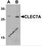 C-Type Lectin Domain Containing 7A antibody, 6833, ProSci, Western Blot image 