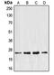 Eukaryotic Translation Elongation Factor 1 Beta 2 antibody, LS-C352130, Lifespan Biosciences, Western Blot image 