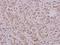 Cell Division Cycle 25A antibody, A01433S76, Boster Biological Technology, Immunohistochemistry paraffin image 