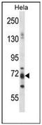 Praja Ring Finger Ubiquitin Ligase 1 antibody, AP53313PU-N, Origene, Western Blot image 
