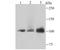 DNA Ligase 4 antibody, A01685-2, Boster Biological Technology, Western Blot image 