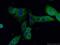 Aldehyde Dehydrogenase 1 Family Member A1 antibody, 22109-1-AP, Proteintech Group, Immunofluorescence image 