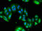 Ubiquitin carboxyl-terminal hydrolase 6 antibody, CSB-PA025747LA01HU, Cusabio, Immunofluorescence image 